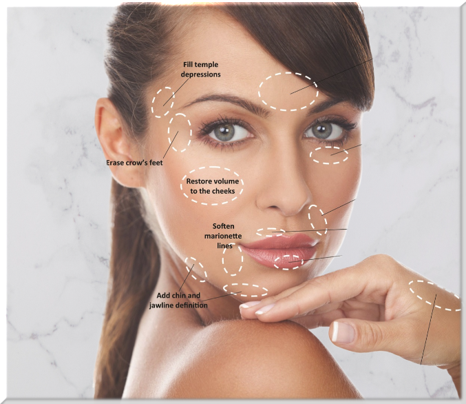 Dermal Fillers Advanced Facial Esthetics In Parma, OH