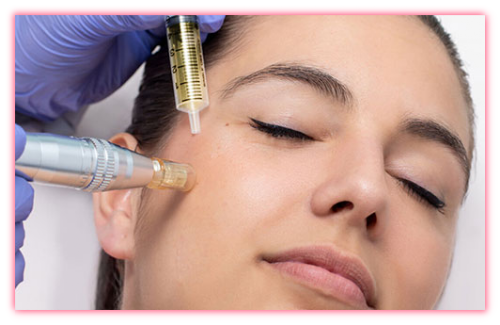 MICRONEEDLING WITH PRF DR.B'SPA | PARMA, OHIO